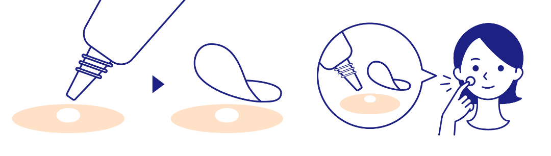 塗って、貼って、翌朝感動!夜用ポイントパッチでWのケア